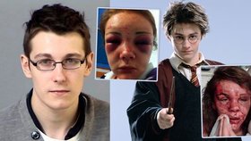 Mladík, který brutálně zbil dvě dívky, které se mu posmívaly, že vypadá jako Harry Potter, byl v dětství často šikanován.