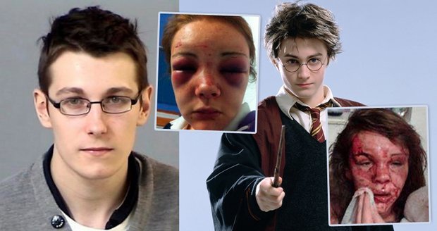 Mladík, který brutálně zbil dvě dívky, které se mu posmívaly, že vypadá jako Harry Potter, byl v dětství často šikanován.