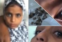 Lékařská záhada: Dívka pláče kameny!