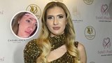 Sabina z Bachelora přiznala: Zpackaná plastika! Půjde znovu pod kudlu