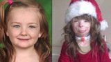 Osmiletá holčička přišla při požáru o celou rodinu: Má dojemné vánoční přání!