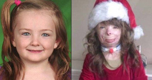 Osmiletá holčička přišla při požáru o celou rodinu: Má dojemné vánoční přání!