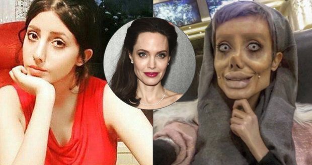 Šílená proměna dívky (19) posedlé Angelinou Jolie: Podívejte se, jak vypadala před 50 plastikami!