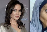 Šílená proměna dívky (19) posedlé Angelinou Jolie: Vypadá jako mrtvola! Zhubla 40 kg a podstoupila 50 operací