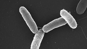 Bakterie salmonely po požití kontaminované potravy pronikají do tenkého střeva, kde se množí