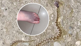 Varování od Jadranu! Holčičku (12) pokousala zmije: Otekla a zmodrala jí noha