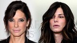 Sandra Bullock: Padesátka na krku a už má rty z botoxu!