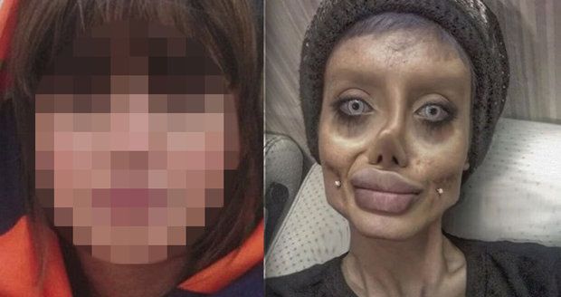 Žena, která vypadá jako mrtvola Angeliny Jolie, odhalila svou pravou tvář: To by nikdo nečekal