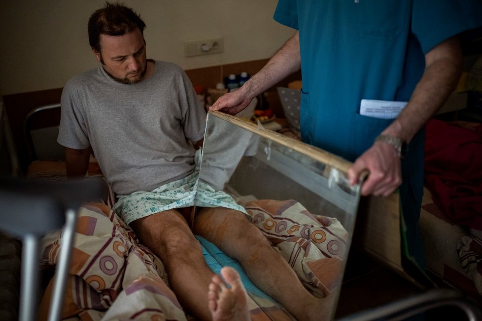 Saša Horochyvskyj (38) přišel o nohu poté, co po něm vystřelil zmatený voják. Považoval ho za špiona