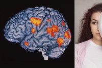 Rozdvojená osobnost a sklony k násilí: Jaké jsou největší mýty o schizofrenii?