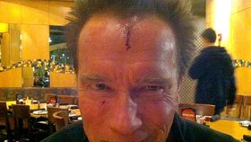 Arnold není neporazitelný, ukázal se s rozbitým čelem