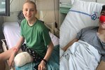 Patnáctiletý Sebík přišel kvůli rakovině o nohu
