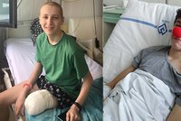 „V těle mám rakovinu.“ Sebík (15) přišel kvůli nádoru o nohu, sbírka mu může pomoci k nové