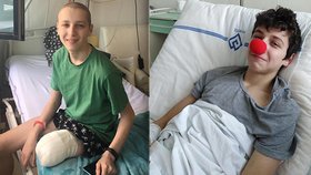 Patnáctiletý Sebík přišel kvůli rakovině o nohu