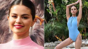 Selena Gomez ukázala obrovskou jizvu v třísle.