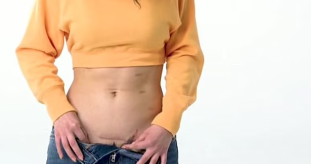 Selan Gomez ukazuje břicho po transplantaci.