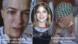Drsný dokument herečky o boji s roztroušenou sklerózou: Mrazivé záběry a příprava na smrt!