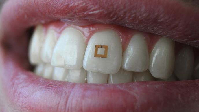 Miniaturní senzor na zub dokáže sledovat a kontrolovat, co jíte a pijete
