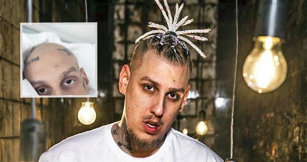 Rapper Separ má za sebou první rok bez rakoviny.
