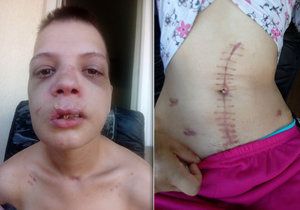 Tyto děsivé snímky zachycují zranění Bulharky donucené k prostituci. Když odmítala šlapat a pokusila se utéci, pasák jí brutálně zbil.