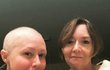 Shannen Doherty zveřejňuje své snímky z průběhu léčby na Instagramu.