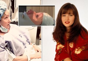 Shannen Dohertyová po první operaci mozku