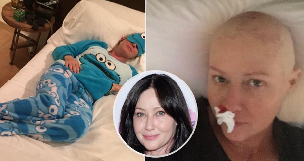 Shannen Doherty ukázala, jak vypadá život s rakovinou.