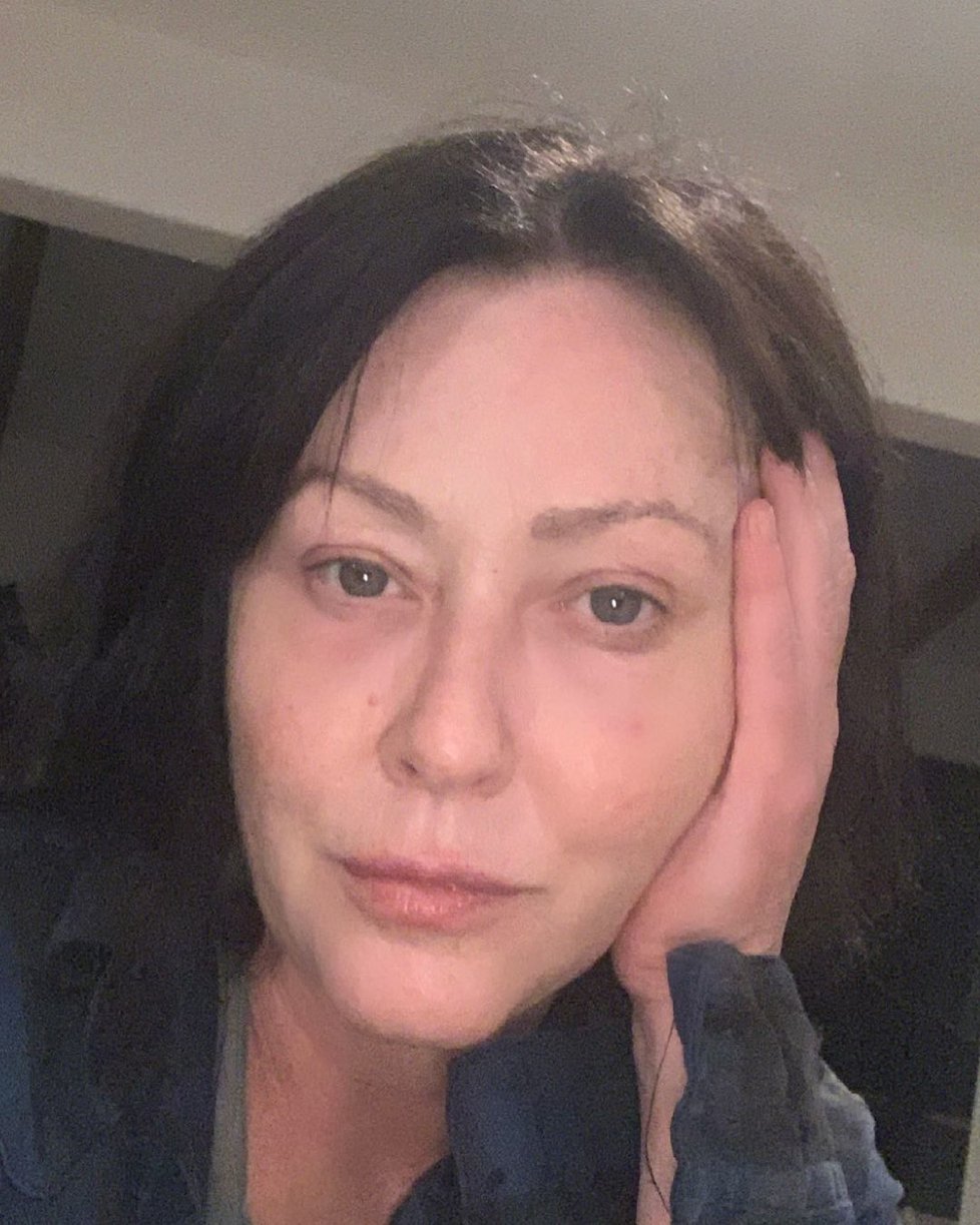 Shannen Doherty v posledním stadiu rakoviny bez příkras.