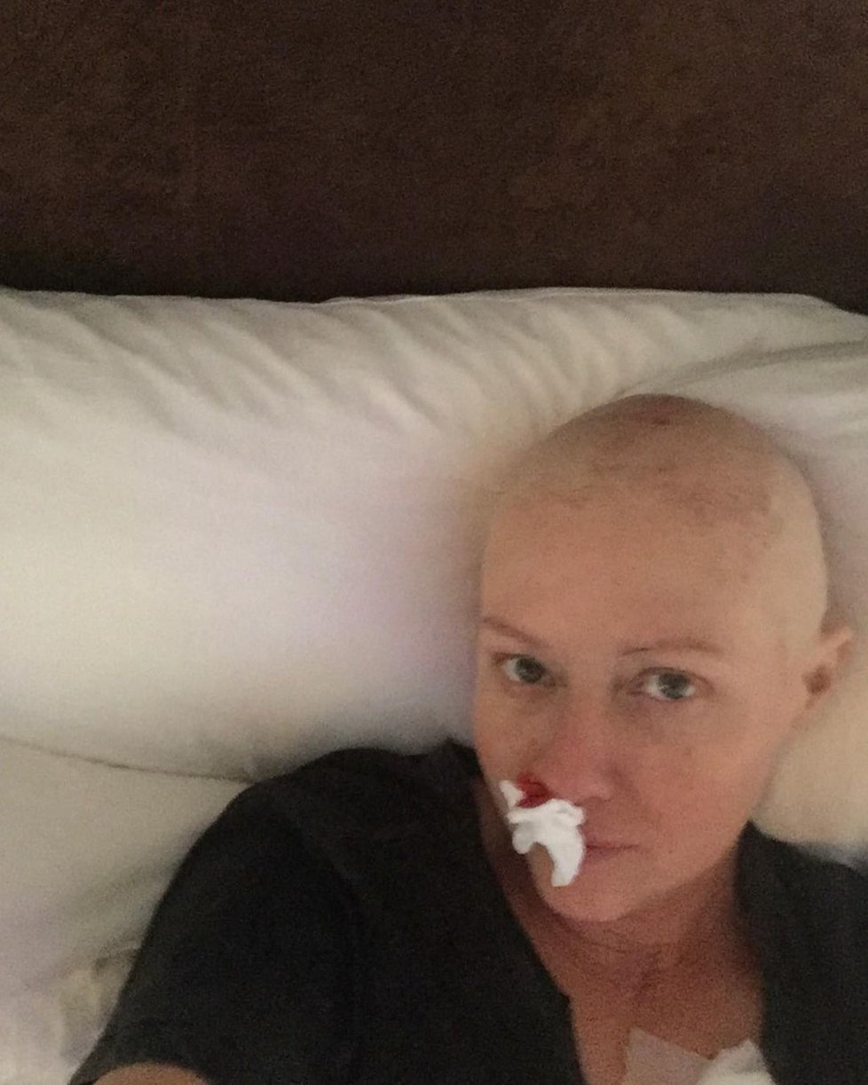 Shannen Doherty ukázala, jak vypadá život s rakovinou.