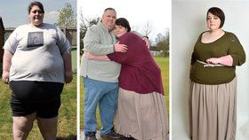 Sharon Hill díky bandáži žaludku zhubla už 76 kilo.