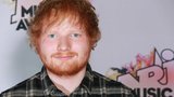 Slavný zpěvák Ed Sheeran zraněn! Srazilo ho auto!