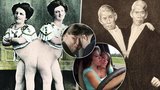 Slavné případy siamských dvojčat: České sestry porodily syna! I setkání s papežem