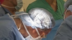 Tým lékařů provádí operaci na oddělení siamských dvojčat