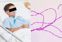 Na Sibiři zuří epidemie antraxu: Chlapec (†13) podlehl, na 90 lidí je v nemocnici