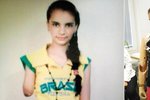 Dívka ze Sýrie přišla o ruku. Novou dostane v Česku
