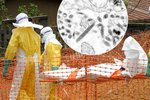 Smrtící ebola může být v mužském spermatu až 9 měsíců.