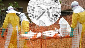 Nové zjištění: Ebolu mohou mít muži ve spermatu až 9 měsíců