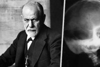 Jak umírali: Freud spáchal sebevraždu morfiem. Zápach nádorů, které měl v puse z kouření, už přitahoval i mouchy!