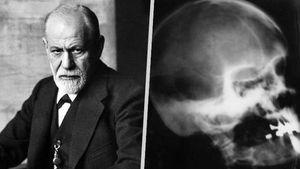 Jak umírali: Freud spáchal sebevraždu morfiem. Zápach nádorů, které měl v puse z kouření, už přitahoval i mouchy!