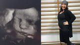 Lucie Šilhánová má 7 týdnů do porodu: Ultrazvuk ukázal mambu nebo king konga!