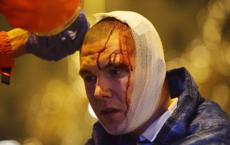 Jednoho z mladíků na Václ avs kém náměstí rachejtle zranila na hlavě.