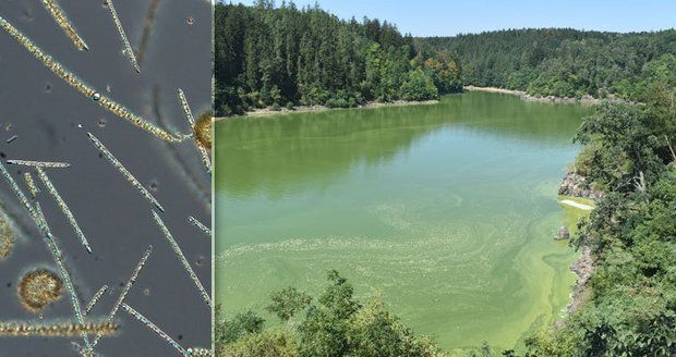 Nebezpečná tropická sinice se dostala do Česka! Poškozuje játra