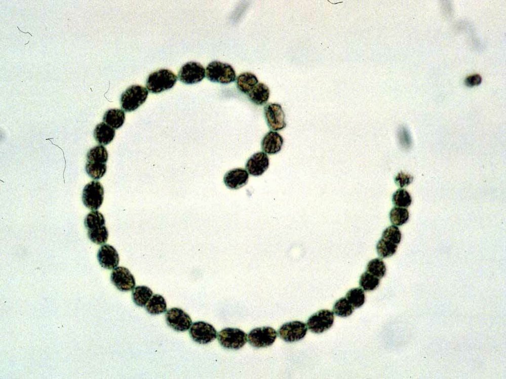 Sinice zvaná Anabaena flosaquae pod mikroskopem. Produkuje zdraví škodlivé látky, které kazí vodu v rybnících