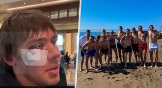 Drsná bitka ukrajinských a ruských fotbalistů: Bydleli na stejném hotelu!