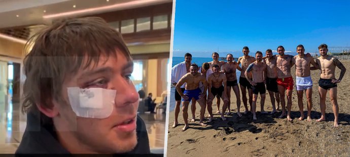 Na hotelu v Turecku došlo k bitce mezi ukrajinskými a ruskými fotbalisty.