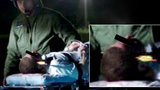Drsné foto: Muž se šípem v hlavě se postřelil sám! Je po operaci mozku