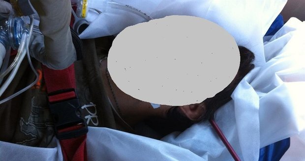 Zranění muže z Rokycanska připomnělo starší případ postřeleného kuší z Karvinska (na snímku)