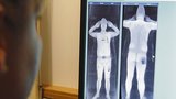 Letištní skenery: Mohou způsobit rakovinu