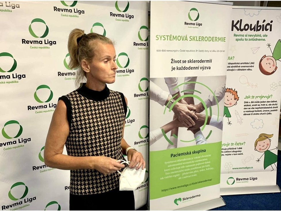 Michaela vede pacientskou skupina Skleroderma