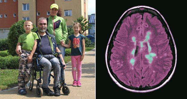 Alena kvůli roztroušené skleróze dostala výpověď. Rodina skončila v dluzích